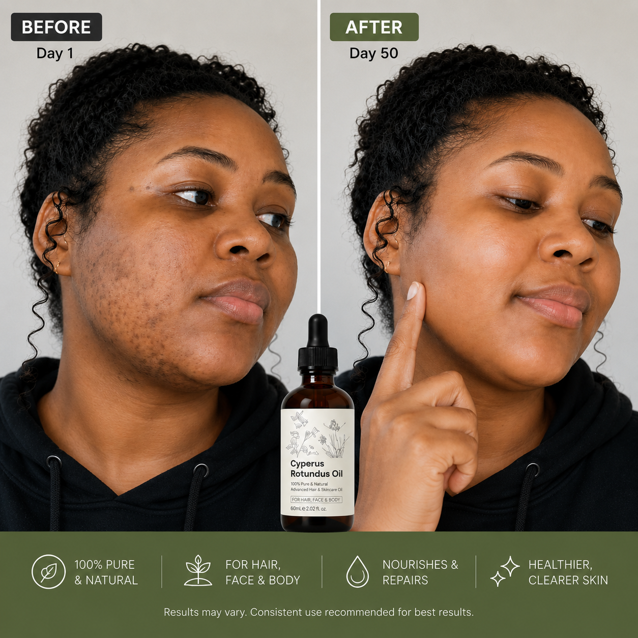 SilkAway™ Cyperus Hair Reduction Oil