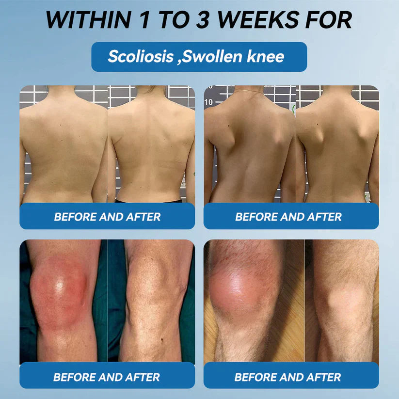 The Brisk Balm™ Joint Relief Cream  🏓⛳🚶‍♂️🏊‍♀️🎾 Targeted Comfort for Active Joints & Everyday Movement ✨