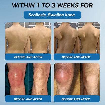 The Brisk Balm™ Joint Relief Cream  🏓⛳🚶‍♂️🏊‍♀️🎾 Targeted Comfort for Active Joints & Everyday Movement ✨