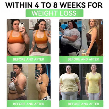 Official Store| 🧑‍⚕️Alcuras™ Moringa × Berberine × AMPK 8-Benefit Slimming & Metabolic Nano Microneedle Patch 🇺🇸  Just once a day · Visible changes in 7 days  ✅ For obesity, loose skin, diabetes, sleep apnea, joint issues, and more
