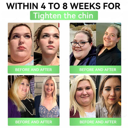 Official Store| Alcuras™🧑‍⚕️ Moringa × Berberine × AMPK 8-Benefit Slimming & Metabolic Nano Microneedle Patch 🇺🇸  Just once a day · Visible changes in 7 days  ✅ For obesity, loose skin, diabetes, sleep apnea, joint issues, and more