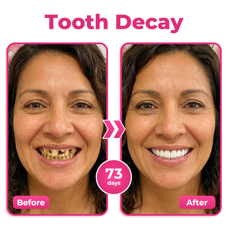Alcuras® Thismile NH-10 Enamel & Gum Advanced Therapy Toothpaste Serum💕