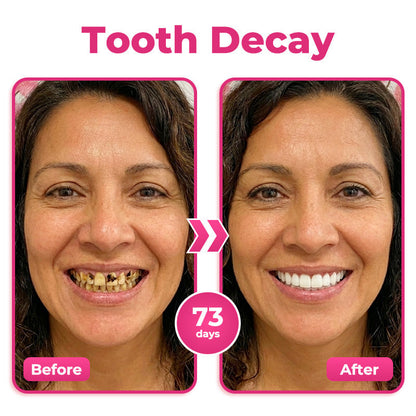 Alcuras® Thismile NH-10 Enamel & Gum Advanced Therapy Toothpaste Serum💕