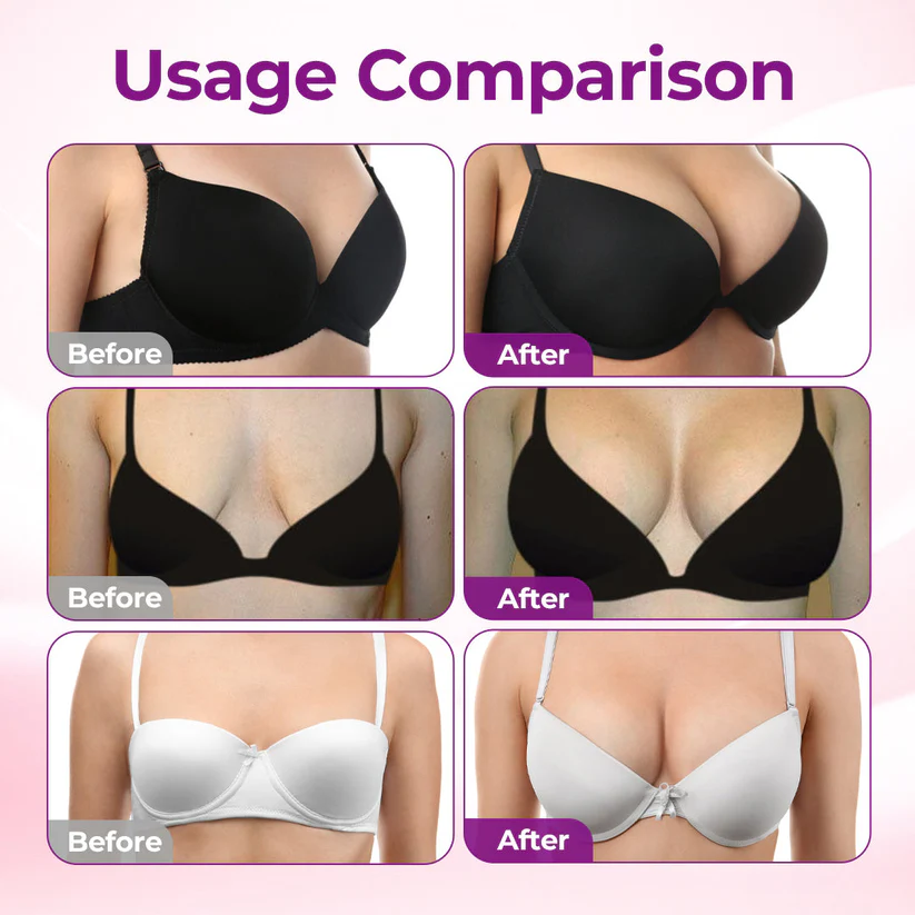 🍓Alcuras® 🦪Targeted Breast Enhancement Advanced Nano Microneedle Patch💃