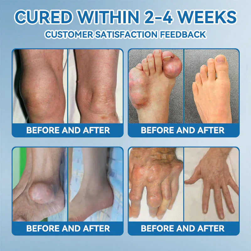 The Brisk Balm™ Joint Relief Cream  🏓⛳🚶‍♂️🏊‍♀️🎾 Targeted Comfort for Active Joints & Everyday Movement ✨