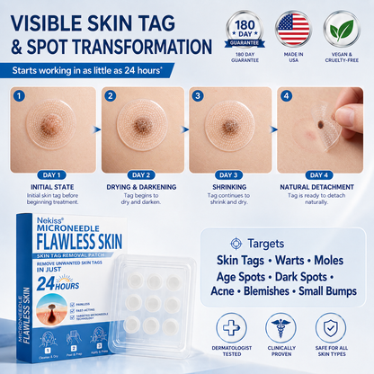👩‍⚕️👍 𝐎𝐟𝐟𝐢𝐜𝐢𝐚𝐥 𝐒𝐭𝐨𝐫𝐞 | 𝑵𝐞𝒌𝐢𝐬𝐬® 🌿 𝐁𝐨𝐭𝐚𝐧𝐢𝐜𝐚𝐥 𝐌𝐢𝐜𝐫𝐨𝐧𝐞𝐞𝐝𝐥𝐞 𝐇𝐲𝐝𝐫𝐨𝐜𝐨𝐥𝐥𝐨𝐢𝐝 𝐏𝐚𝐭𝐜𝐡 (𝐅𝐨𝐫 𝐒𝐤𝐢𝐧 𝐓𝐚𝐠𝐬, 𝐒𝐦𝐚𝐥𝐥 𝐒𝐤𝐢𝐧 𝐆𝐫𝐨𝐰𝐭𝐡𝐬, 𝐖𝐚𝐫𝐭𝐬, 𝐌𝐨𝐥𝐞𝐬, 𝐀𝐠𝐞 𝐒𝐩𝐨𝐭𝐬 & 𝐏𝐢𝐠𝐦𝐞𝐧𝐭𝐚𝐭𝐢𝐨𝐧 𝐂𝐨𝐧𝐜𝐞𝐫𝐧𝐬)