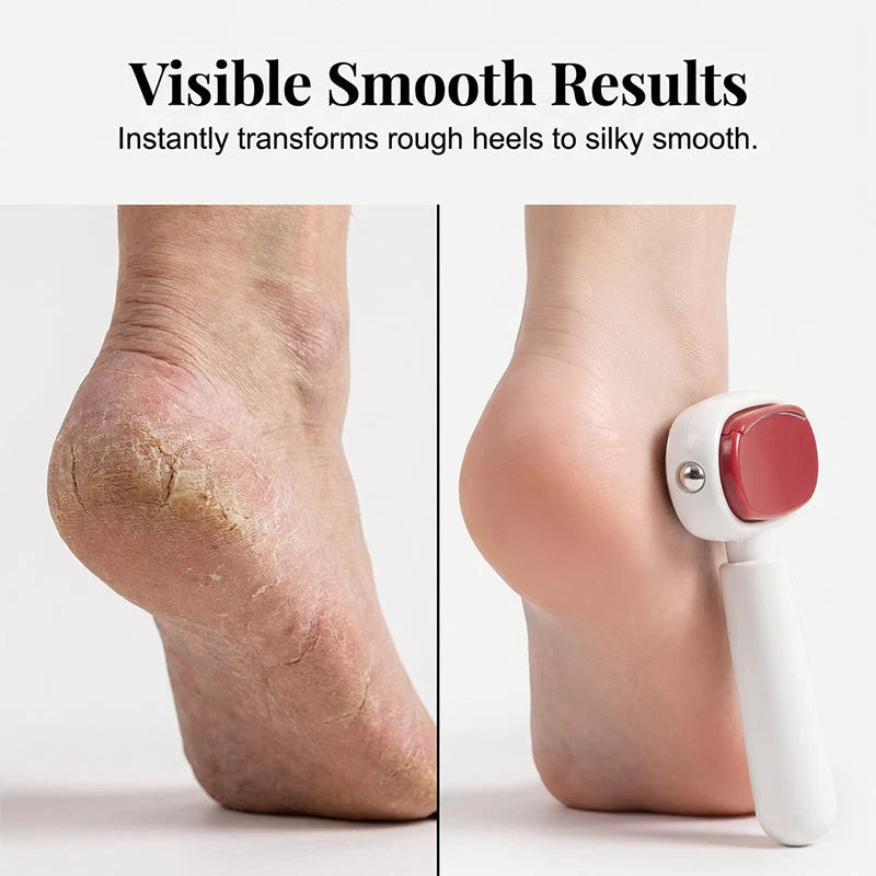 🦶Dual‑Sided Foot Callus Remover, Replaceable Stainless Steel Blade Foot Scraper