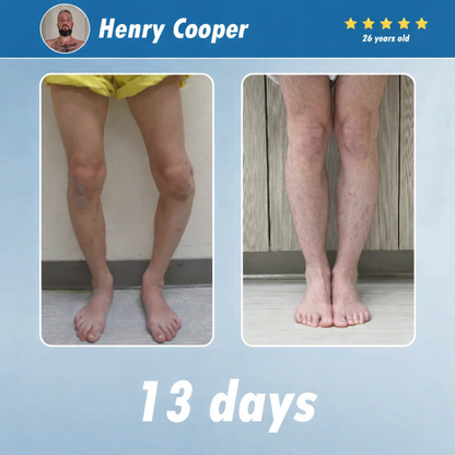 The Brisk Balm™ Joint Relief Cream  🏓⛳🚶‍♂️🏊‍♀️🎾 Targeted Comfort for Active Joints & Everyday Movement ✨