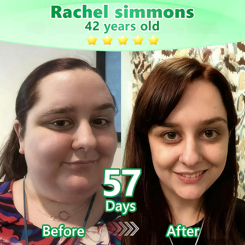 Official Store🧑‍⚕️| Alcuras™ Moringa × Berberine × AMPK 8-Benefit Slimming & Metabolic Nano Microneedle Patch 🇺🇸  Just once a day · Visible changes in 7 days  ✅ For obesity, loose skin, diabetes, sleep apnea, joint issues, and more