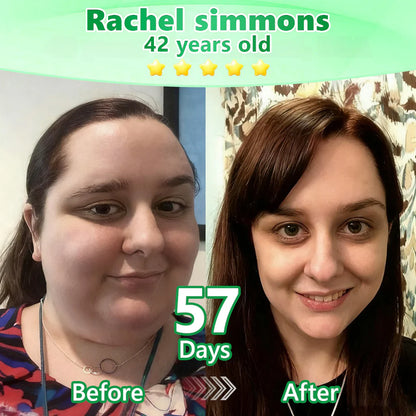 Official Store🧑‍⚕️| Alcuras™ Moringa × Berberine × AMPK 8-Benefit Slimming & Metabolic Nano Microneedle Patch 🇺🇸  Just once a day · Visible changes in 7 days  ✅ For obesity, loose skin, diabetes, sleep apnea, joint issues, and more