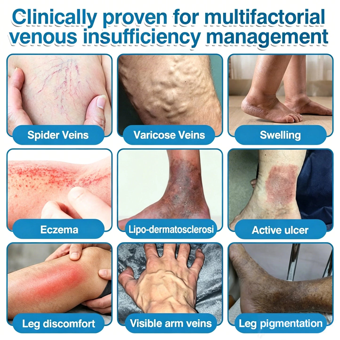 🇨🇦👨‍⚕️✅GFOUK® VeinRepair Microneedle Patch Roll⚡Instant Relief, Long-Term Results