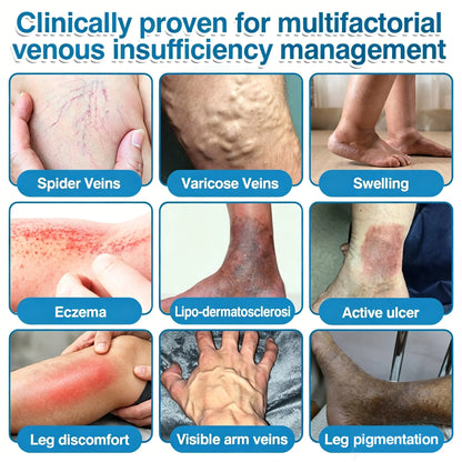 🇨🇦👨‍⚕️✅GFOUK® VeinRepair Microneedle Patch Roll⚡Instant Relief, Long-Term Results