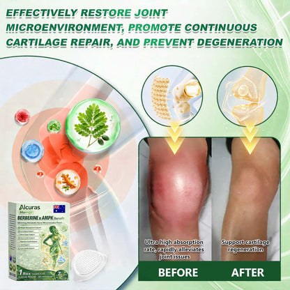 🧑‍⚕️𝐎𝐟𝐟𝐢𝐜𝐢𝐚𝐥 AU 𝐒𝐭𝐨𝐫𝐞 | Alcuras® 𝐌𝐨𝐫𝐢𝐧𝐠𝐚 · 𝐁𝐞𝐞 𝐯𝐞𝐧𝐨𝐦 · 𝐁𝐞𝐫𝐛𝐞𝐫𝐢𝐧𝐞 × 𝐍𝐀𝐃+ 𝟖-𝐢𝐧-𝟏 𝐀𝐝𝐯𝐚𝐧𝐜𝐞𝐝 𝐍𝐚𝐧𝐨 𝐌𝐢𝐜𝐫𝐨𝐧𝐞𝐞𝐝𝐥𝐞 𝐏𝐚𝐭𝐜𝐡 — 𝐎𝐧𝐜𝐞 𝐃𝐚𝐢𝐥𝐲, 𝐕𝐢𝐬𝐢𝐛𝐥𝐞 𝐑𝐞𝐬𝐮𝐥𝐭𝐬 𝐢𝐧 𝟕 𝐃𝐚𝐲𝐬 (obesity, 🅛🅞🅞🅢🅔 🅢🅚🅘🅝,diabetes, sleep apnea, joint issues, and more For)
