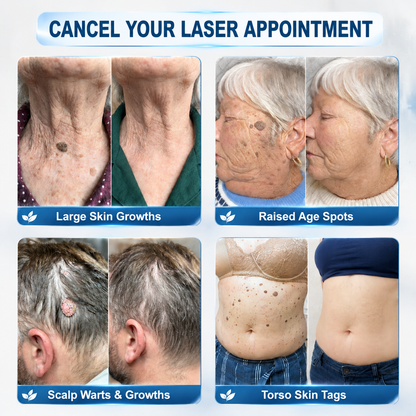 👩‍⚕️👍 𝐎𝐟𝐟𝐢𝐜𝐢𝐚𝐥 𝐒𝐭𝐨𝐫𝐞 | 𝑵𝐞𝒌𝐢𝐬𝐬® 🌿 𝐁𝐨𝐭𝐚𝐧𝐢𝐜𝐚𝐥 𝐌𝐢𝐜𝐫𝐨𝐧𝐞𝐞𝐝𝐥𝐞 𝐇𝐲𝐝𝐫𝐨𝐜𝐨𝐥𝐥𝐨𝐢𝐝 𝐏𝐚𝐭𝐜𝐡 (𝐅𝐨𝐫 𝐒𝐤𝐢𝐧 𝐓𝐚𝐠𝐬, 𝐒𝐦𝐚𝐥𝐥 𝐒𝐤𝐢𝐧 𝐆𝐫𝐨𝐰𝐭𝐡𝐬, 𝐖𝐚𝐫𝐭𝐬, 𝐌𝐨𝐥𝐞𝐬, 𝐀𝐠𝐞 𝐒𝐩𝐨𝐭𝐬 & 𝐏𝐢𝐠𝐦𝐞𝐧𝐭𝐚𝐭𝐢𝐨𝐧 𝐂𝐨𝐧𝐜𝐞𝐫𝐧𝐬)