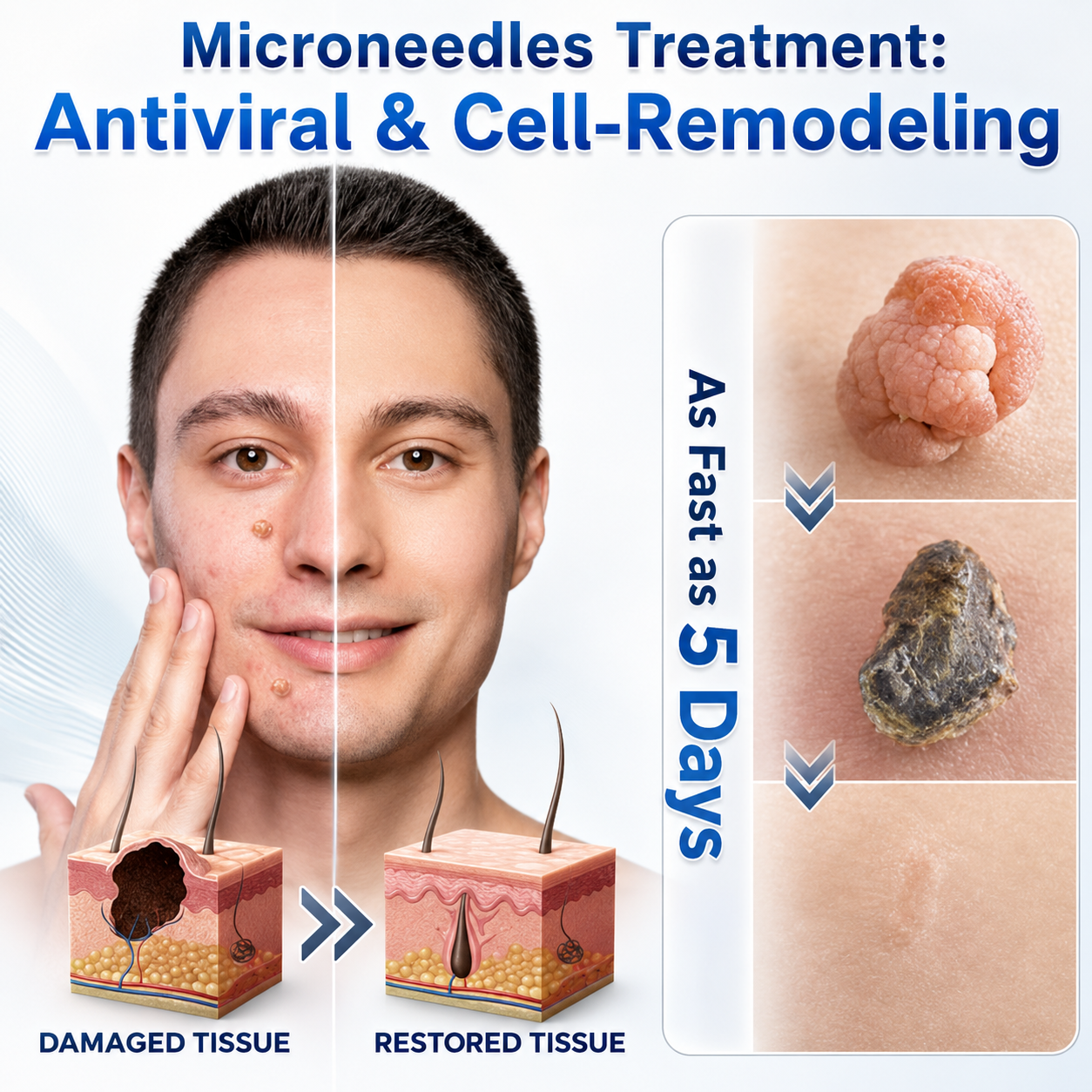 👩‍⚕️👍 𝐎𝐟𝐟𝐢𝐜𝐢𝐚𝐥 𝐒𝐭𝐨𝐫𝐞 | 𝑵𝐞𝒌𝐢𝐬𝐬® 🌿 𝐁𝐨𝐭𝐚𝐧𝐢𝐜𝐚𝐥 𝐌𝐢𝐜𝐫𝐨𝐧𝐞𝐞𝐝𝐥𝐞 𝐇𝐲𝐝𝐫𝐨𝐜𝐨𝐥𝐥𝐨𝐢𝐝 𝐏𝐚𝐭𝐜𝐡 (𝐅𝐨𝐫 𝐒𝐤𝐢𝐧 𝐓𝐚𝐠𝐬, 𝐒𝐦𝐚𝐥𝐥 𝐒𝐤𝐢𝐧 𝐆𝐫𝐨𝐰𝐭𝐡𝐬, 𝐖𝐚𝐫𝐭𝐬, 𝐌𝐨𝐥𝐞𝐬, 𝐀𝐠𝐞 𝐒𝐩𝐨𝐭𝐬 & 𝐏𝐢𝐠𝐦𝐞𝐧𝐭𝐚𝐭𝐢𝐨𝐧 𝐂𝐨𝐧𝐜𝐞𝐫𝐧𝐬)