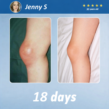 The Brisk Balm™ Joint Relief Cream  🏓⛳🚶‍♂️🏊‍♀️🎾 Targeted Comfort for Active Joints & Everyday Movement ✨