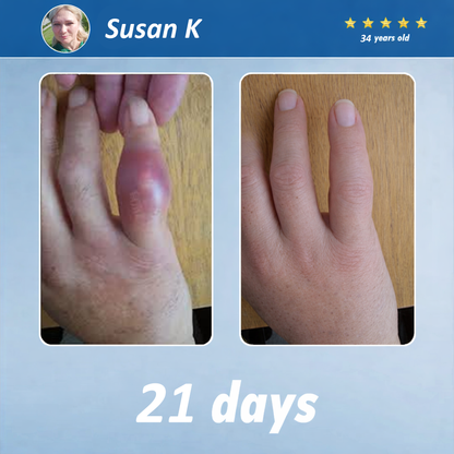 The Brisk Balm™ Joint Relief Cream  🏓⛳🚶‍♂️🏊‍♀️🎾 Targeted Comfort for Active Joints & Everyday Movement ✨