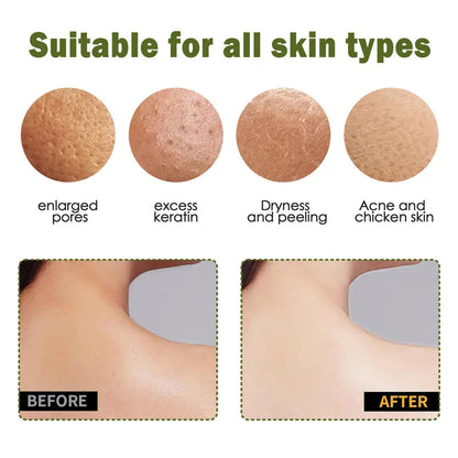 4 Counts Soft Rubber Shower Scrubber for Efficient Cleansing Body