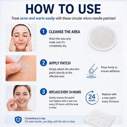 👩‍⚕️👍 𝐎𝐟𝐟𝐢𝐜𝐢𝐚𝐥 𝐒𝐭𝐨𝐫𝐞 | 𝑵𝐞𝒌𝐢𝐬𝐬® 🌿 𝐁𝐨𝐭𝐚𝐧𝐢𝐜𝐚𝐥 𝐌𝐢𝐜𝐫𝐨𝐧𝐞𝐞𝐝𝐥𝐞 𝐇𝐲𝐝𝐫𝐨𝐜𝐨𝐥𝐥𝐨𝐢𝐝 𝐏𝐚𝐭𝐜𝐡 (𝐅𝐨𝐫 𝐒𝐤𝐢𝐧 𝐓𝐚𝐠𝐬, 𝐒𝐦𝐚𝐥𝐥 𝐒𝐤𝐢𝐧 𝐆𝐫𝐨𝐰𝐭𝐡𝐬, 𝐖𝐚𝐫𝐭𝐬, 𝐌𝐨𝐥𝐞𝐬, 𝐀𝐠𝐞 𝐒𝐩𝐨𝐭𝐬 & 𝐏𝐢𝐠𝐦𝐞𝐧𝐭𝐚𝐭𝐢𝐨𝐧 𝐂𝐨𝐧𝐜𝐞𝐫𝐧𝐬)
