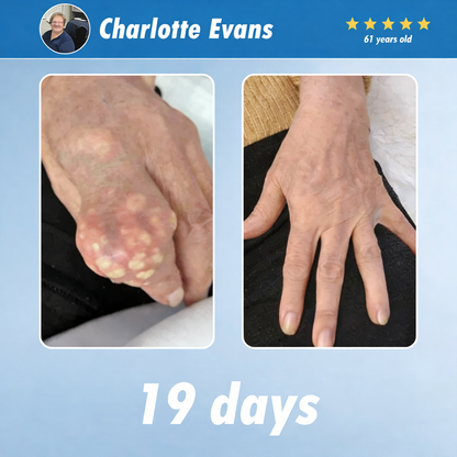 The Brisk Balm™ Joint Relief Cream  🏓⛳🚶‍♂️🏊‍♀️🎾 Targeted Comfort for Active Joints & Everyday Movement ✨